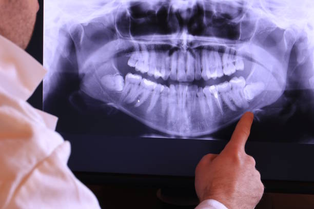 Best Chipped Tooth Repair Near Me  in Varnell, GA